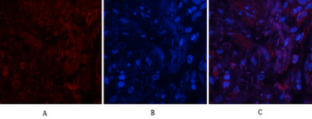 PI 3-kinase p85/p55 (phospho Tyr467/199) Polyclonal Antibody