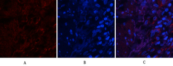 PI 3-kinase p85/p55 (phospho Tyr467/199) Polyclonal Antibody