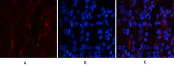 PI 3-kinase p85/p55 (phospho Tyr467/199) Polyclonal Antibody