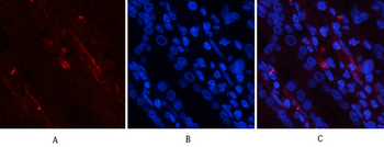 PI 3-kinase p85/p55 (phospho Tyr467/199) Polyclonal Antibody