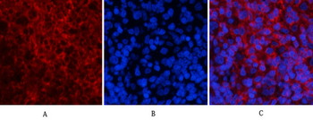 PI 3-kinase p85/p55 (phospho Tyr467/199) Polyclonal Antibody