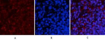 NFκB-p65 (phospho Ser536) Polyclonal Antibody