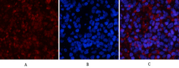 NFκB-p65 (phospho Ser536) Polyclonal Antibody