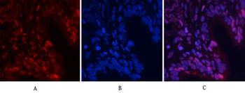 NFκB-p65 (phospho Ser529) Polyclonal Antibody