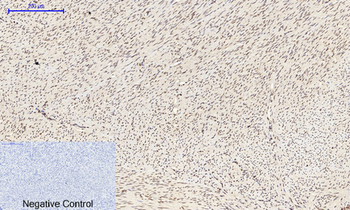 NFκB-p65 (phospho Ser529) Polyclonal Antibody