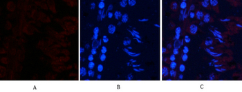JNK1/2/3 (phospho Thr183) Polyclonal Antibody