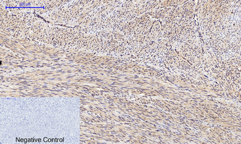 JNK1/2/3 (phospho Thr183) Polyclonal Antibody