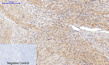JNK1/2/3 (phospho Thr183) Polyclonal Antibody
