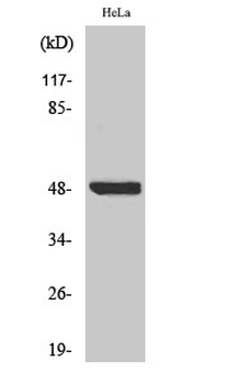 IκB-β (phospho Ser23) Polyclonal Antibody