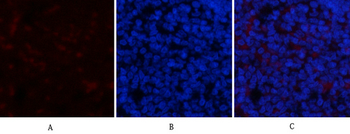 IκB-α (phospho Ser32/S36) Polyclonal Antibody