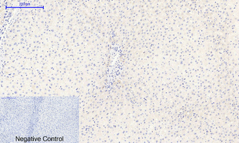 IκB-α (phospho Ser32/S36) Polyclonal Antibody