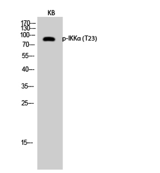IKKα (phospho Thr23) Polyclonal Antibody