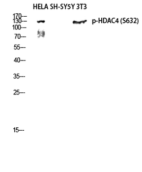 HDAC4 (phospho Ser632) Polyclonal Antibody