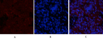 GSK3β (phospho Ser9) Polyclonal Antibody
