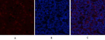GSK3β (phospho Ser9) Polyclonal Antibody