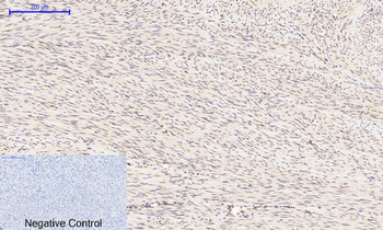 GSK3β (phospho Ser9) Polyclonal Antibody