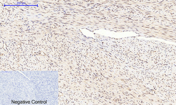 GSK3β (phospho Ser9) Polyclonal Antibody