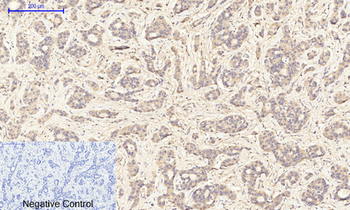 GSK3β (phospho Ser9) Polyclonal Antibody