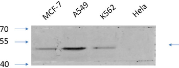 GSK3α/β (phospho Tyr279/216) Polyclonal Antibody