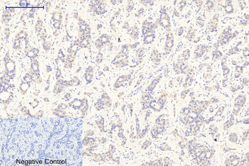 GSK3α/β (phospho Tyr279/216) Polyclonal Antibody