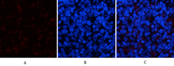 ERK 1/2 (phospho Tyr204) Polyclonal Antibody