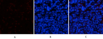 ERK 1/2 (phospho Tyr204) Polyclonal Antibody