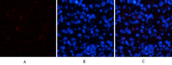 ERK 1/2 (phospho Tyr204) Polyclonal Antibody