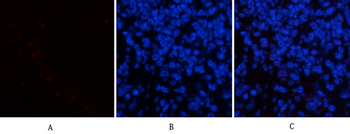 ERK 1/2 (phospho Tyr204) Polyclonal Antibody