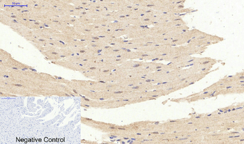 ERK 1/2 (phospho Tyr204) Polyclonal Antibody