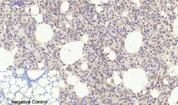 ERK 1/2 (phospho Tyr204) Polyclonal Antibody