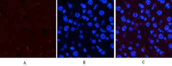 ERK 1/2 (phospho Thr202) Polyclonal Antibody