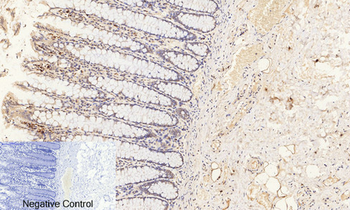 ERK 1/2 (phospho Thr202) Polyclonal Antibody