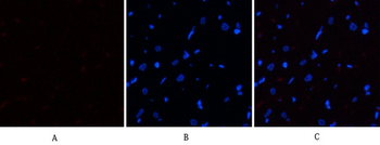 eIF2α (phospho Ser51) Polyclonal Antibody