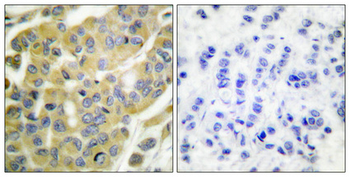Cytokeratin 8 (phospho Ser73) Polyclonal Antibody