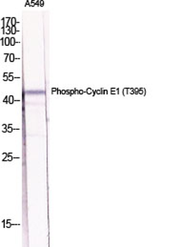 Cyclin E1 (phospho Thr395) Polyclonal Antibody