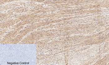 CREB-1 (phospho Ser133) Polyclonal Antibody