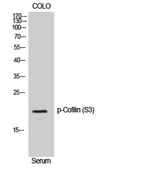 Cofilin (phospho Ser3) Polyclonal Antibody