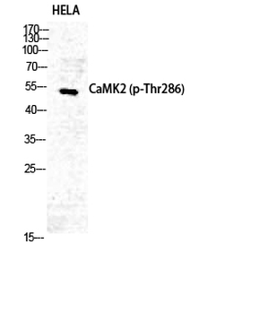 CaMKIIα/δ (phospho Thr286) Polyclonal Antibody