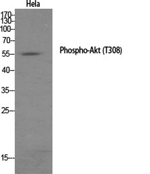 Akt (phospho Thr308) Polyclonal Antibody
