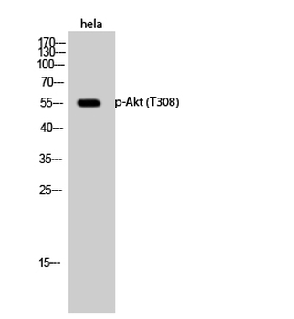 Akt (phospho Thr308) Polyclonal Antibody