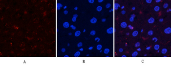 Akt (phospho Ser473) Polyclonal Antibody