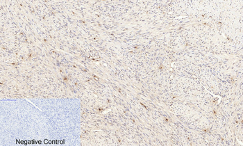 Akt (phospho Ser473) Polyclonal Antibody