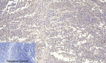 Akt (phospho Ser473) Polyclonal Antibody
