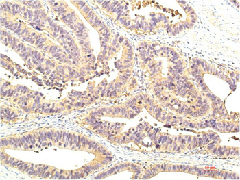 STAT1 mouse Monoclonal Antibody(8H11)