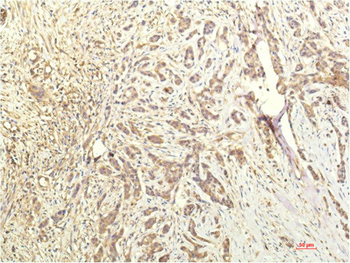 STAT1 mouse Monoclonal Antibody(8H11)