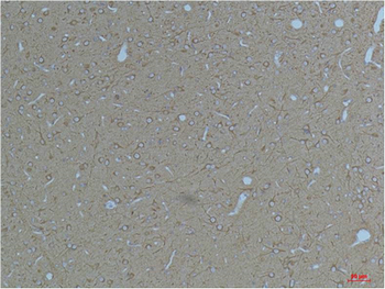 Kv11.3 Polyclonal Antibody