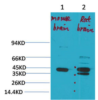 KCNK9 (TASK-3) Polyclonal Antibody