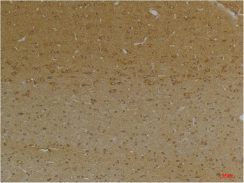 KCNK9 (TASK-3) Polyclonal Antibody