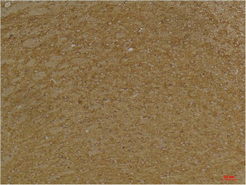 KCNK9 (TASK-3) Polyclonal Antibody