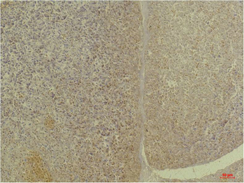 GLP1R Polyclonal Antibody